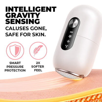 GlowShaver® Electric Foot Callus Remover